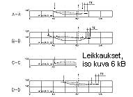 [Leikkaukset]